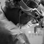 Por que o Pós-Carnaval é o Momento Decisivo para sua Rinoplastia