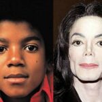 O nariz de Michael Jackson: o que o caso mais famoso da cirurgia plástica ainda tem a nos ensinar